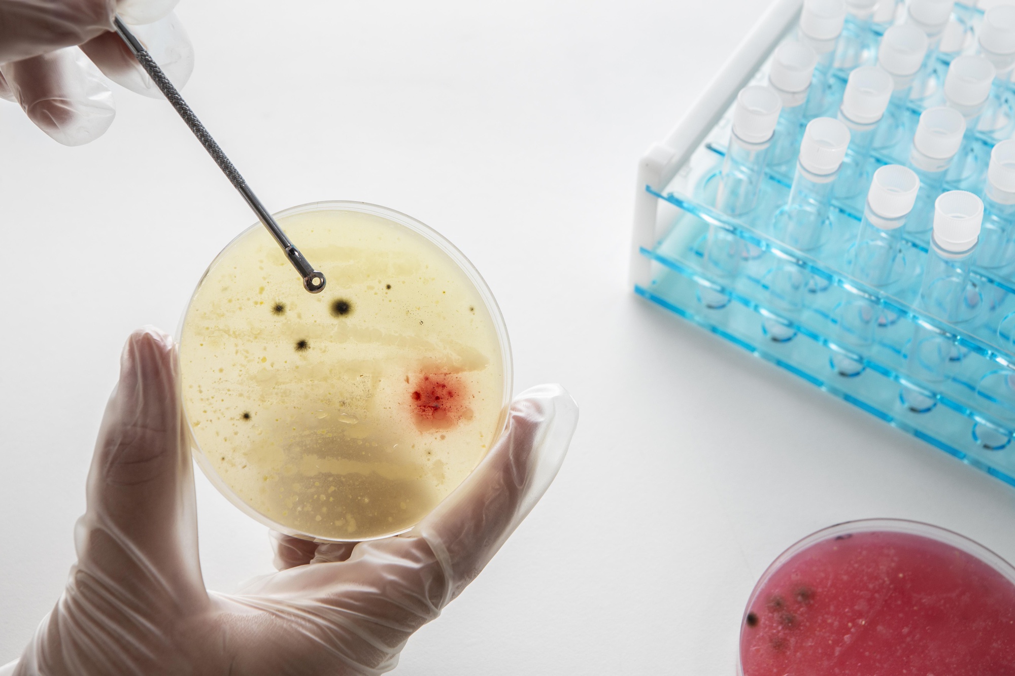 IVF with Fresh Transfer