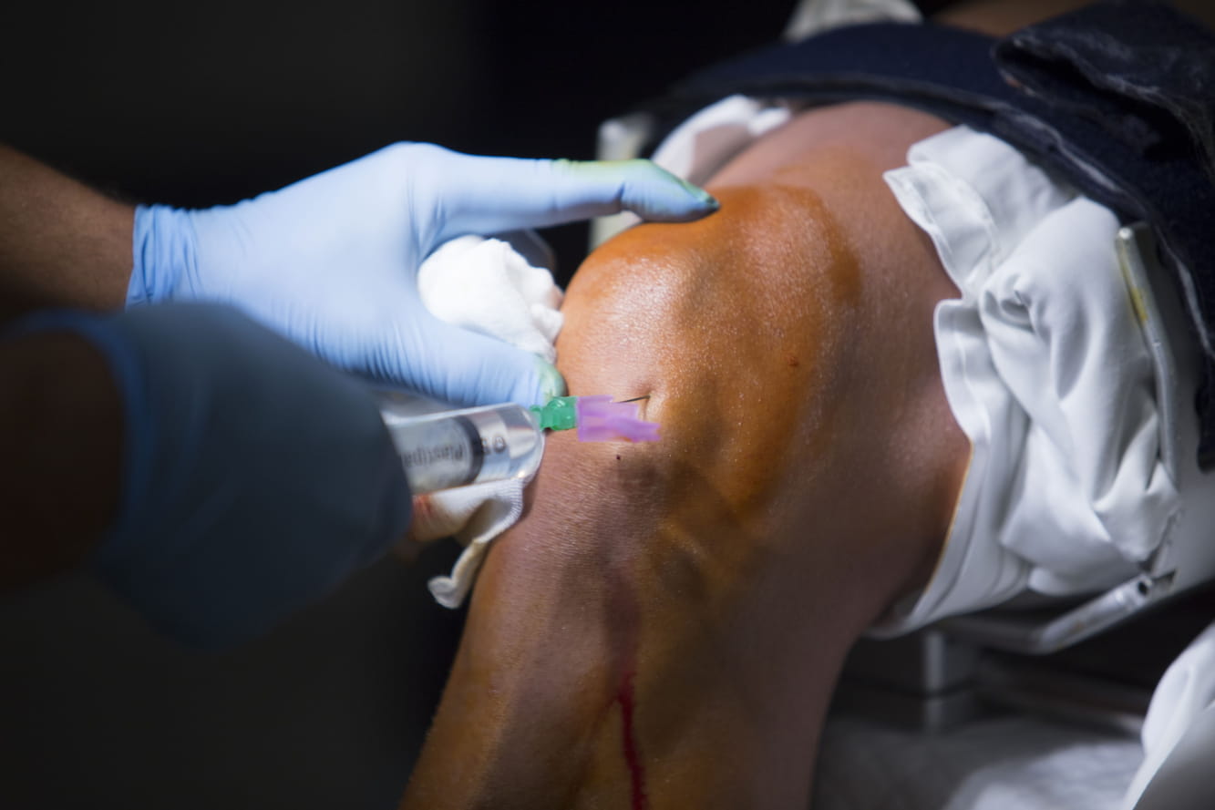 ACL Reconstruction Surgery Treatment-Medvoyage