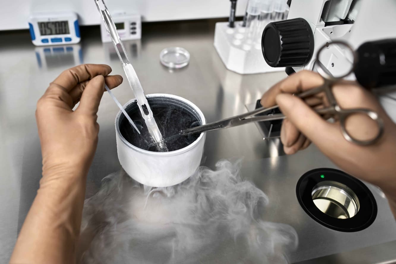 IVF with Frozen Transfer procedure - Medvoyage