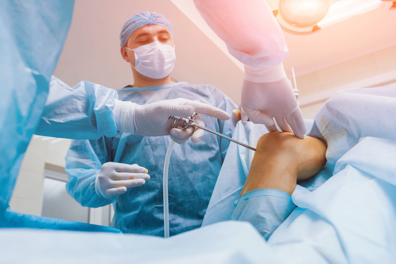 Knee Arthroscopy - Medvoyage