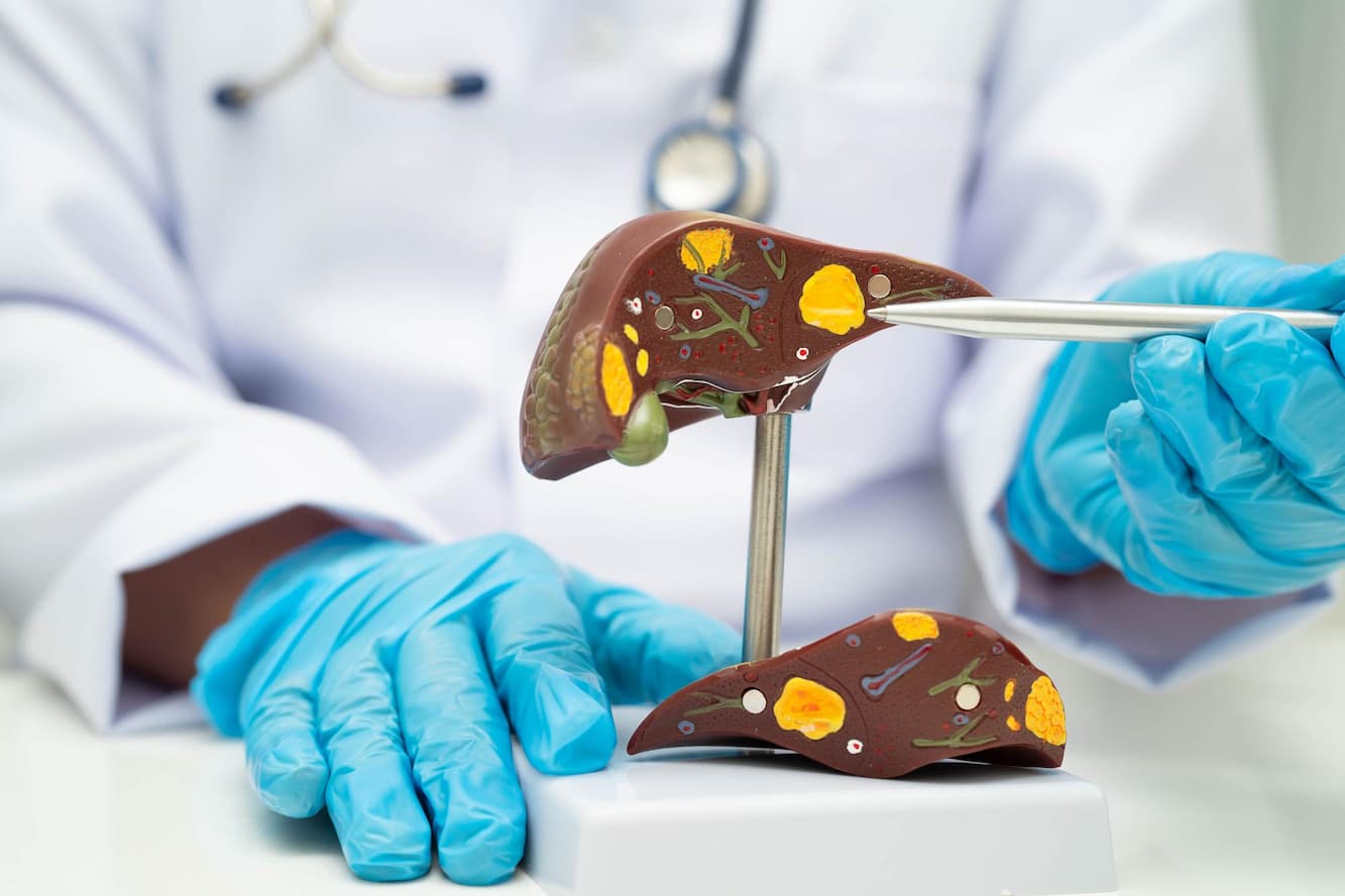 Liver Transplant - Medvoyage