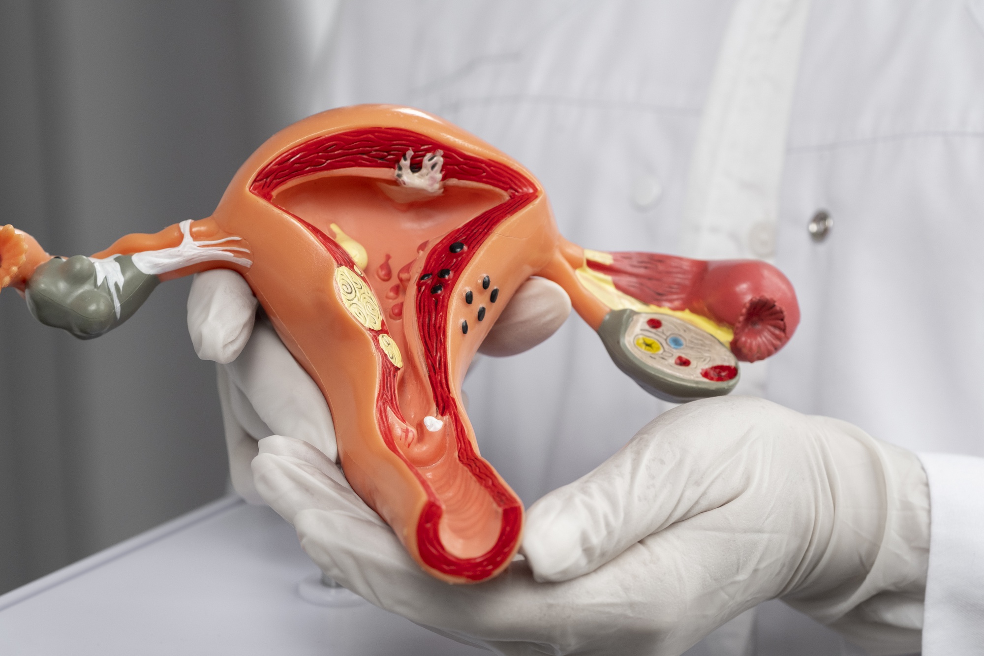 Diagnostic Laparoscopy