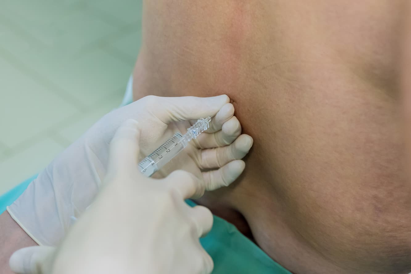 Lumbar Puncture