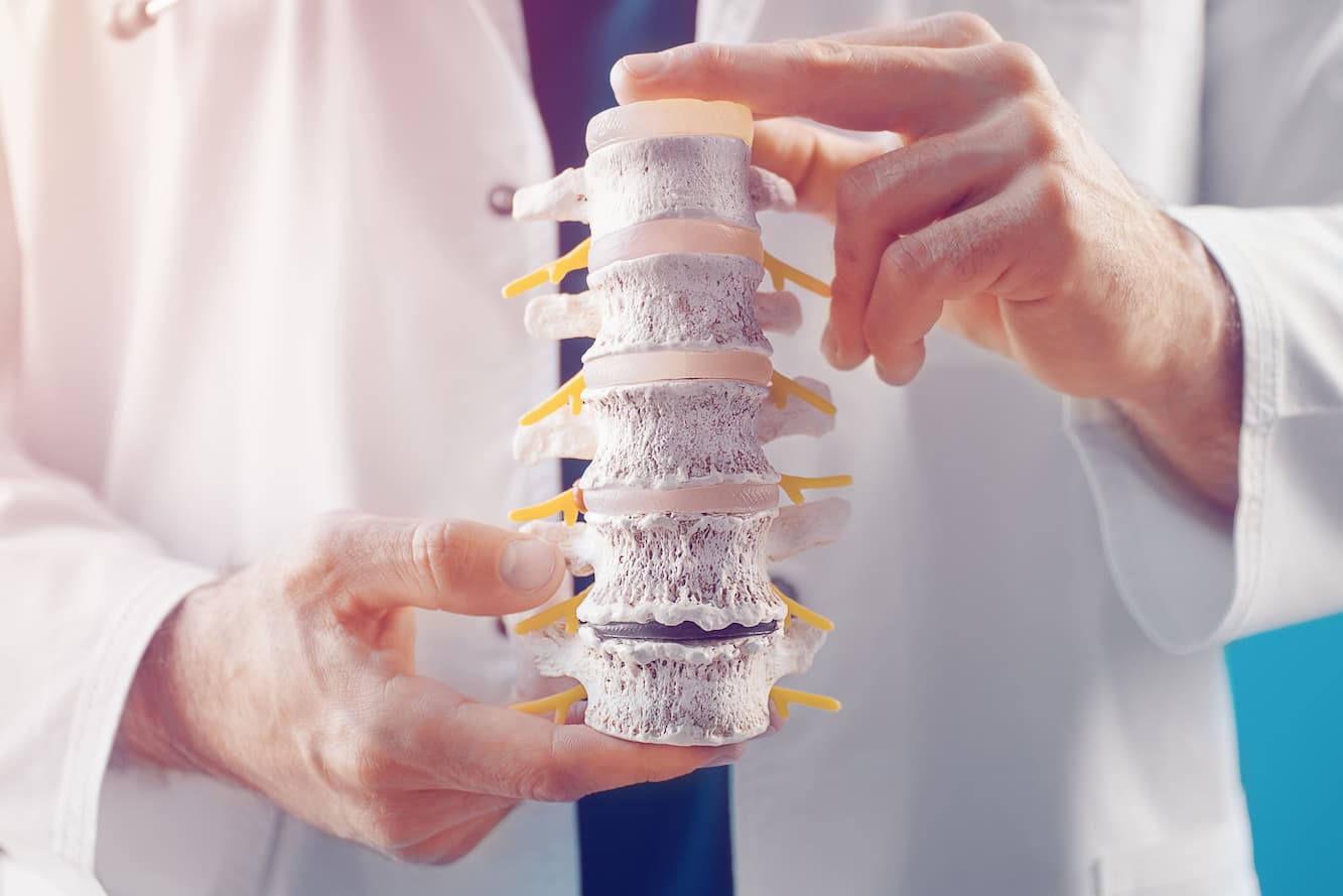 Spinal Fusion