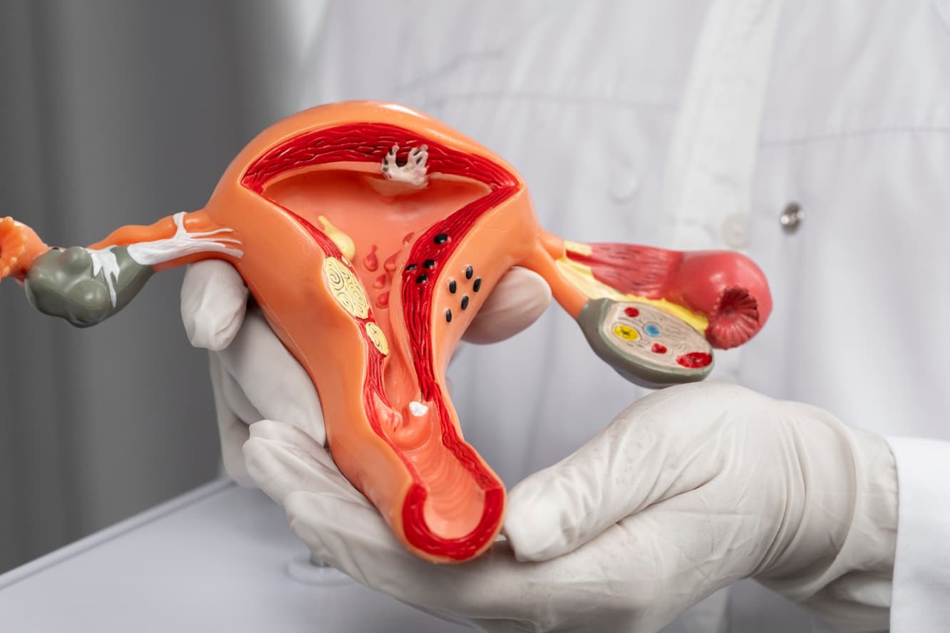 Diagnostic Laparoscopy
