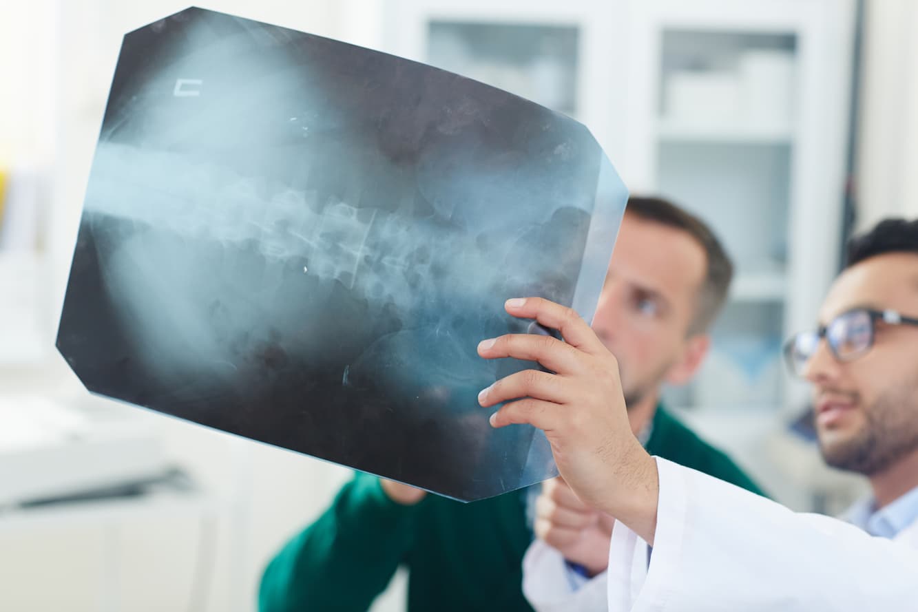 Lumbar Decompression Surgery